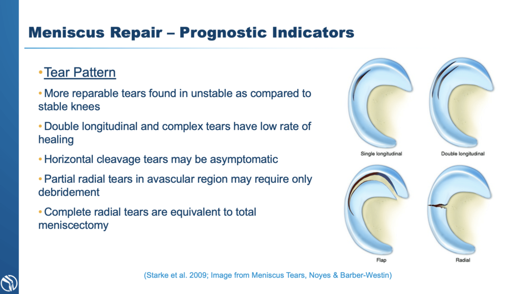 A Complete Guide to Meniscus Tears and their Treatment Diagnosis